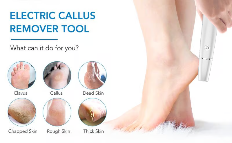 Electric Foot Callus Remover Rechargeable File for Smooth Heels and Dry Hard Skin
