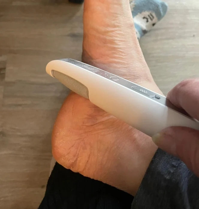 Electric Foot Callus Remover Rechargeable File for Smooth Heels and Dry Hard Skin