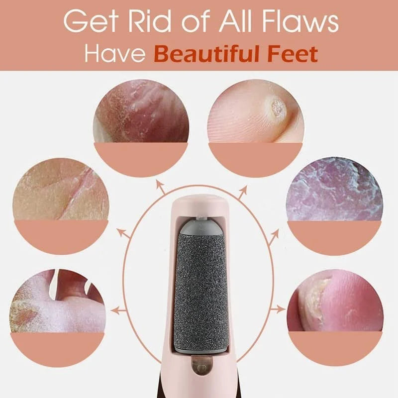 Electric Foot Callus Remover Rechargeable File for Smooth Heels and Dry Hard Skin